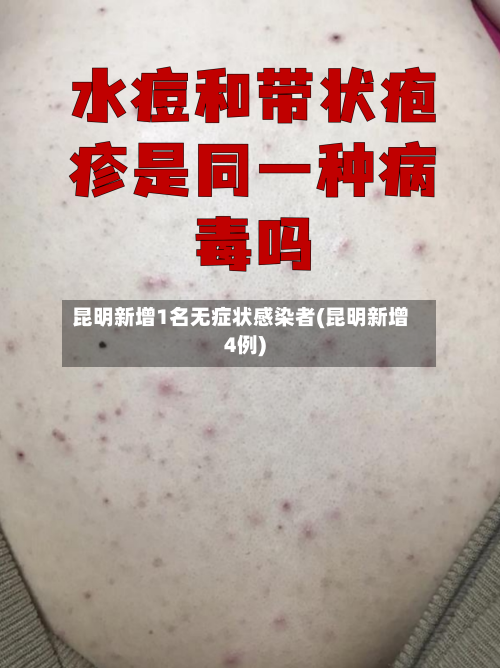 昆明新增1名无症状感染者(昆明新增4例)-第3张图片