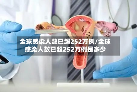 全球感染人数已超252万例/全球感染人数已超252万例是多少